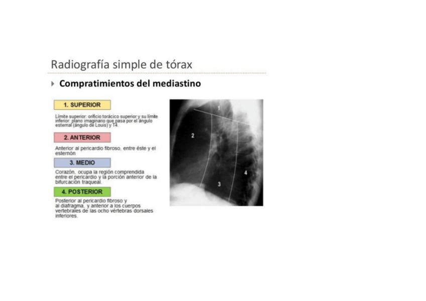 Miniatura del documento Zonas-del-mediastino.pdf