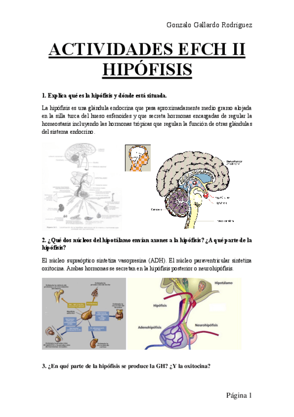 Miniatura del documento ACTIVIDADES-EFCH-II-TEMA-HIPOFISIS.pdf