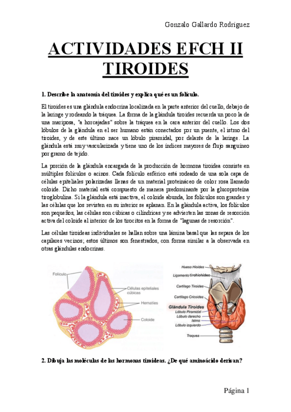 Miniatura del documento ACTIVIDADES-EFCH-II-TIROIDES.pdf