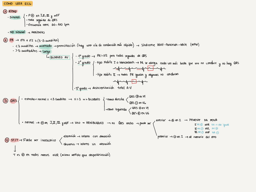 Miniatura del documento ESQUEMA-ECG.pdf