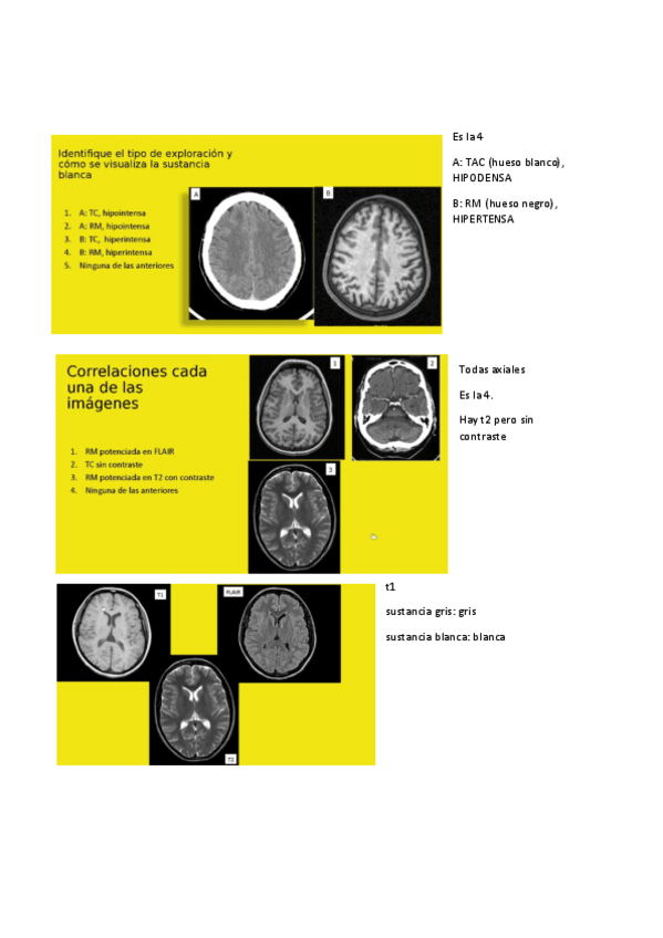Miniatura del documento SEMINARIO-RADIOLOGIA-NEURO.pdf