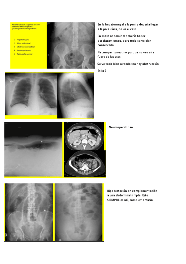 Miniatura del documento seminario-radiologia-abdomen.pdf