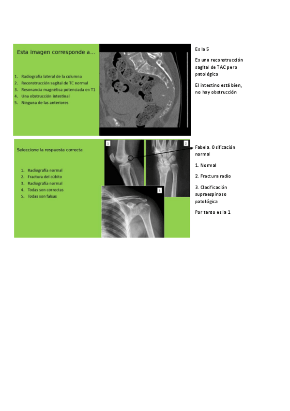 Miniatura del documento seminarios-radiologia-locomotor.pdf