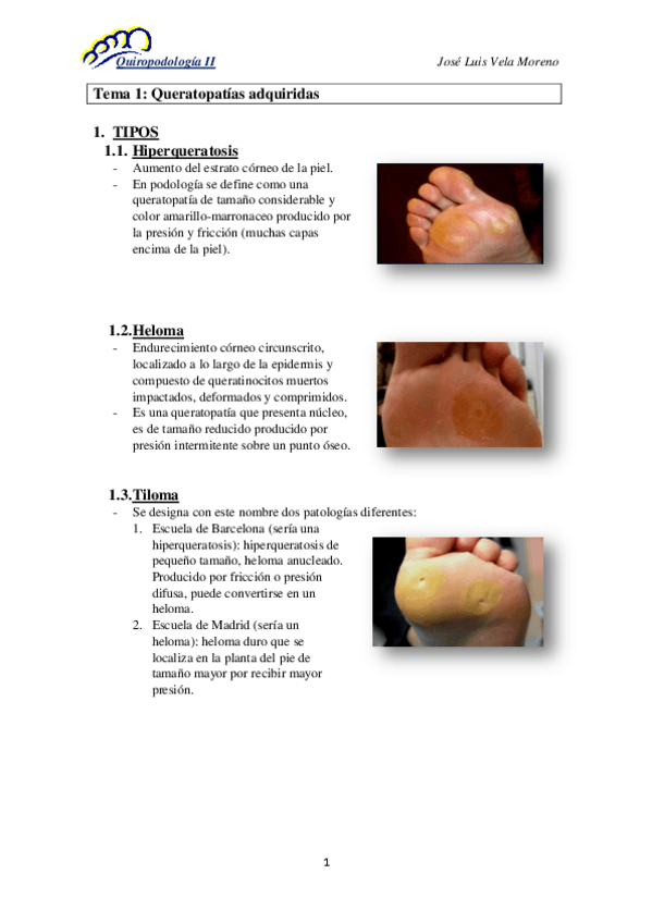 Miniatura del documento Tema-1-Queratopatias-adquiridas-bien-copia.pdf