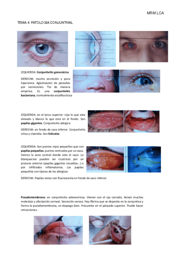 Miniatura del documento TEMA-4.pdf