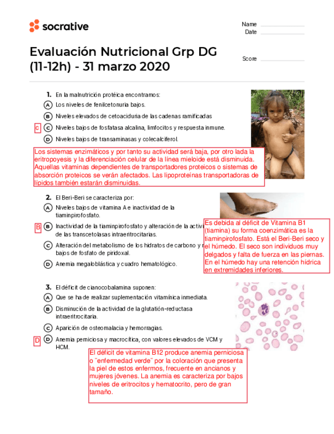 Miniatura del documento Test-Evaluacion-Nutricional-Resuelto.pdf