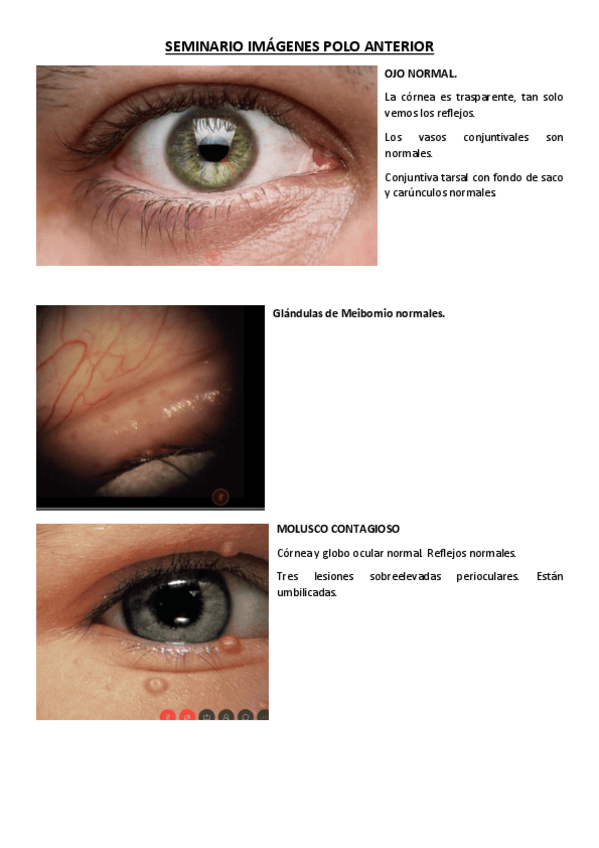 Miniatura del documento SEMINARIO-IMAGENES-POLO-ANTERIOR.pdf