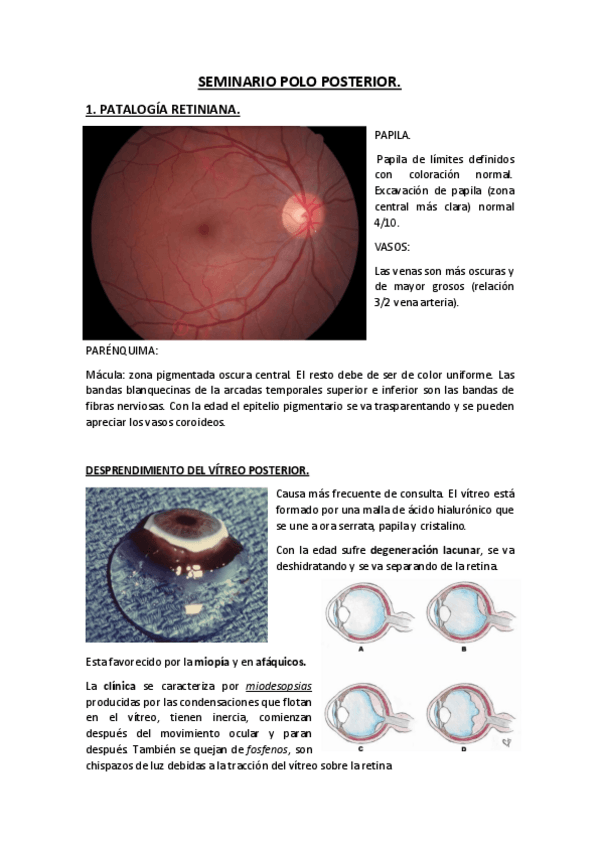 Miniatura del documento SEMINARIO-POLO-POSTERIOR.pdf