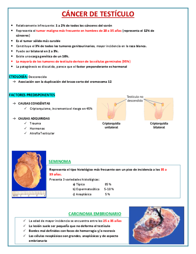 Miniatura del documento CANCER-DE-TESTICULO.pdf