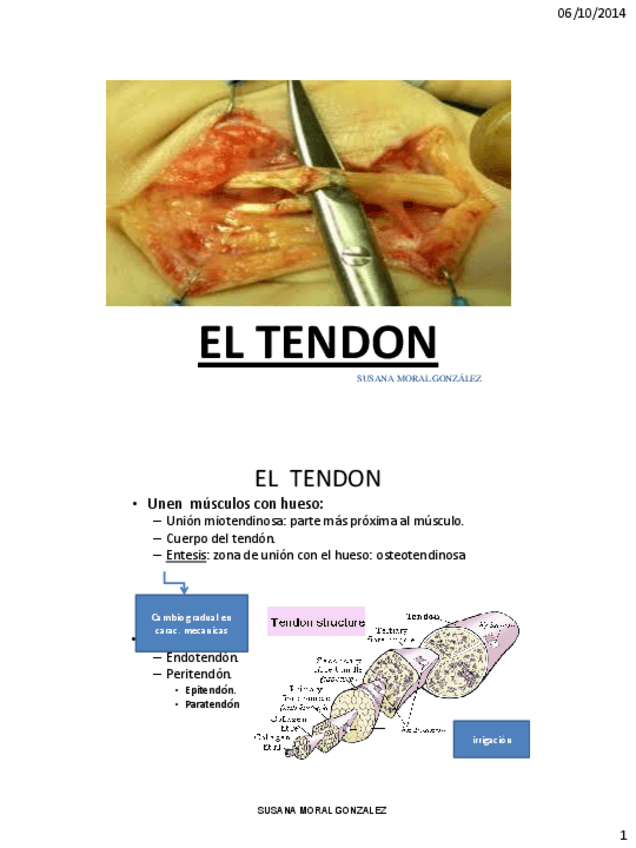 Miniatura del documento T1-EL-TENDON.pdf