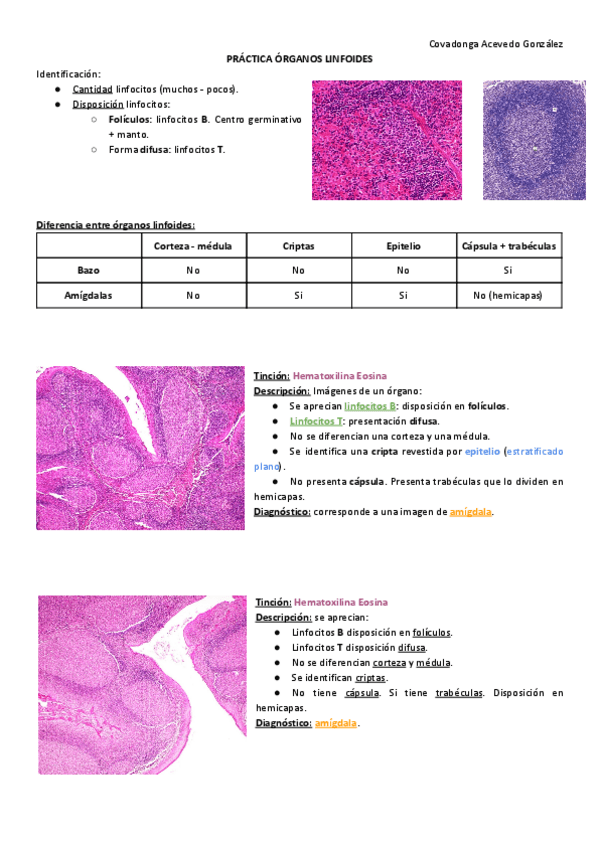 Miniatura del documento PRACTICA-7-ORGANOS-LINFOIDES.pdf