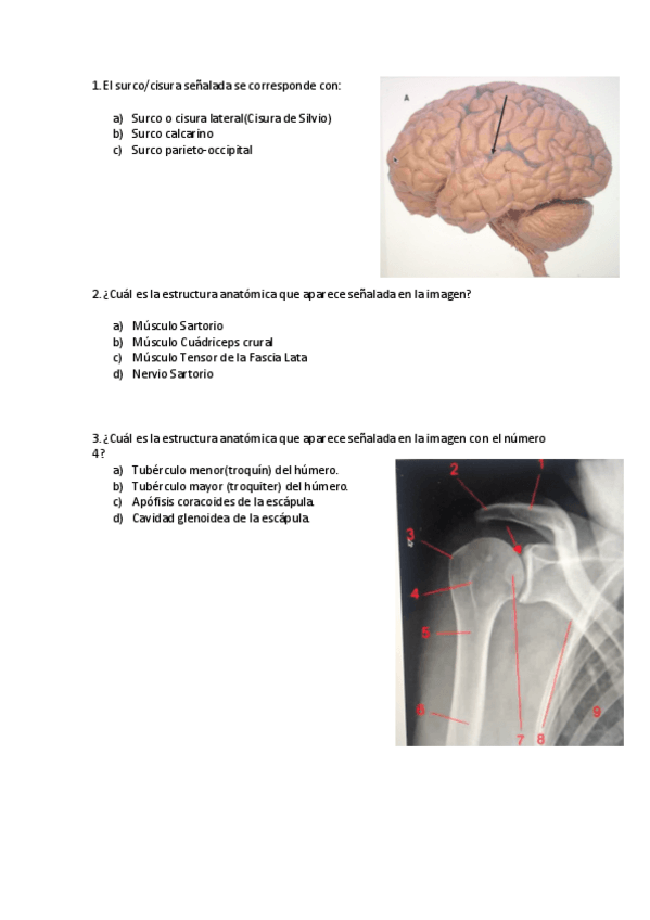 Miniatura del documento Ex-final-PRACTICO-ANATO-II-2020.pdf