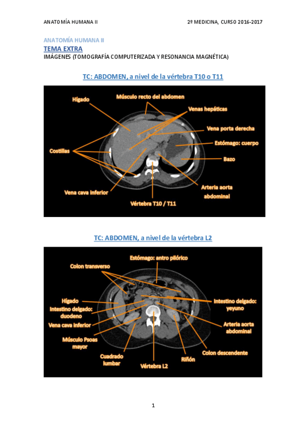 Miniatura del documento TAC y RM (EXAMEN PRÁCTICO).pdf