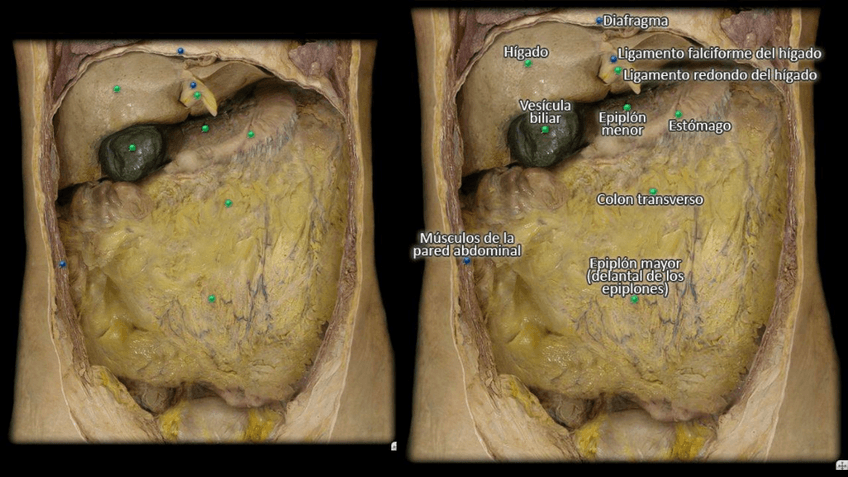 Miniatura del documento DISECCIÓN (EXAMEN PRÁCTICO).pdf
