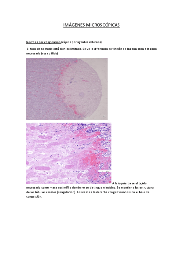 Miniatura del documento MICROSCOPICAS-NECROSIS.pdf