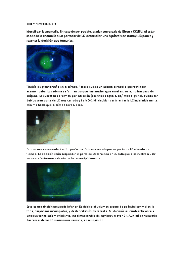 Miniatura del documento Ejercicios-tema-8-covid.pdf