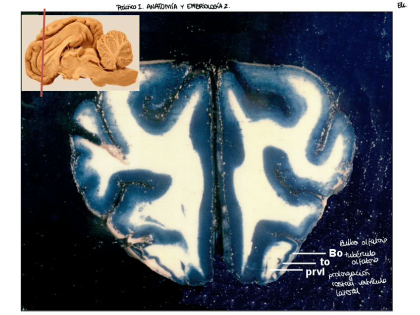 Miniatura del documento Cortes-Cerebro.pdf