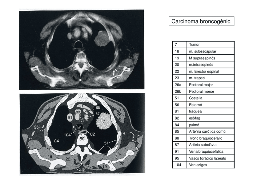 Miniatura del documento patologia-torax.pdf