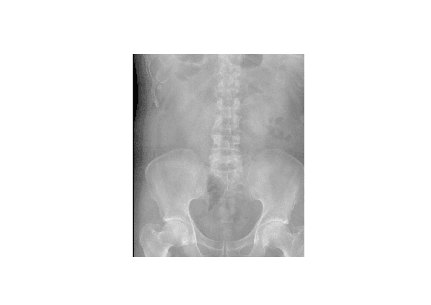Miniatura del documento imagenes-radiologicas-sist-renal.pdf