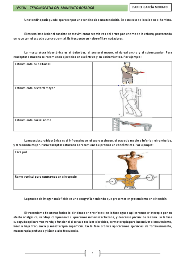 Miniatura del documento Lesión - Tendinopatía del manguito rotador.pdf