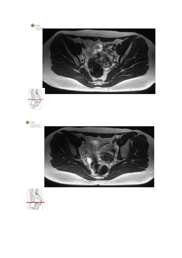 Miniatura del documento RNM-PELVIS-ANATOMIA.docx