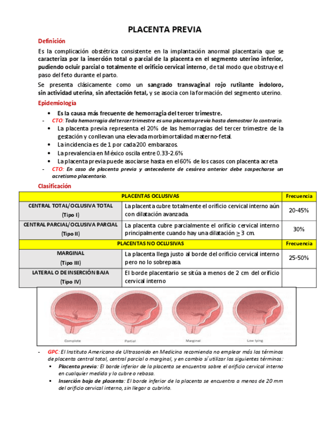 Miniatura del documento Placenta-previa.pdf