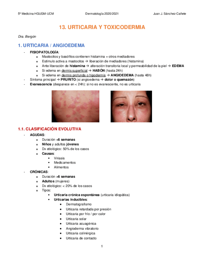 Miniatura del documento 14-URTICARIA-Y-TOXICODERMIA.pdf