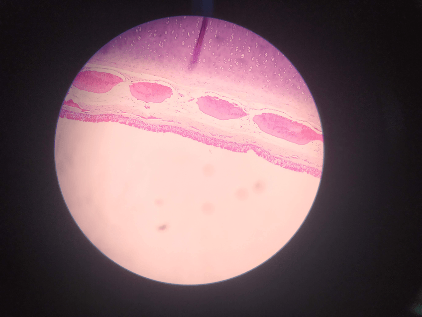 Miniatura del documento TRAQUEA.jpg