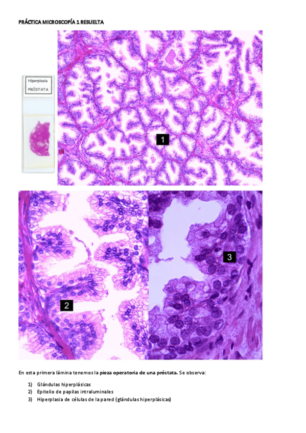 Miniatura del documento PRACTICA-MICROSCOPIA-1-RESUELTA.pdf