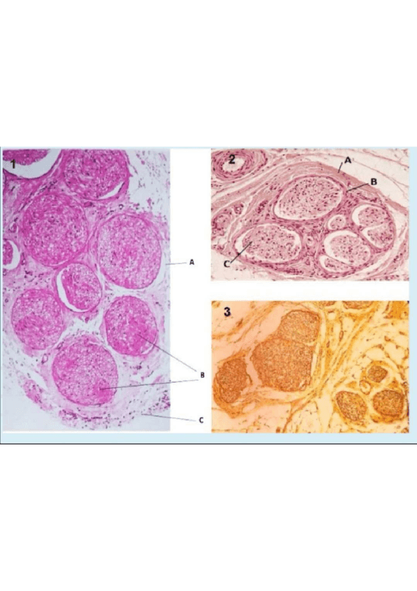 Miniatura del documento Recuperacion.pdf