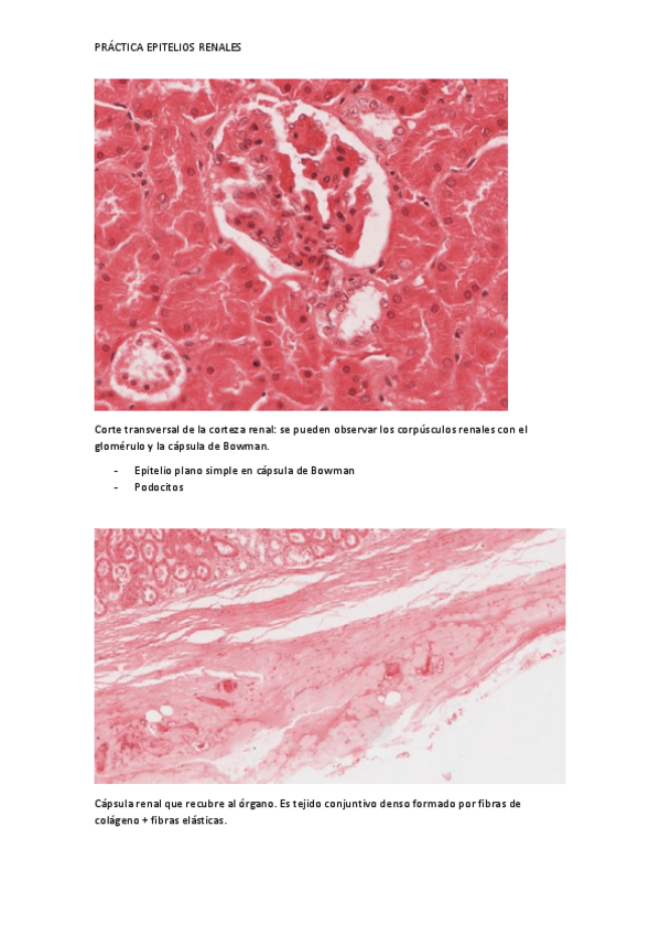 Miniatura del documento PRACTICA-RINON.pdf