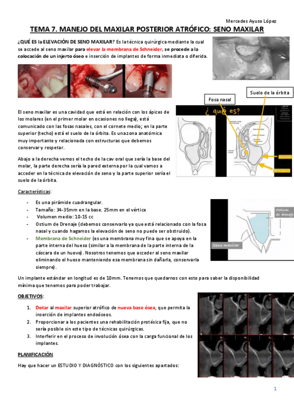 Miniatura del documento TEMA-7-cirugia-bucal-avanz-e-implant.pdf