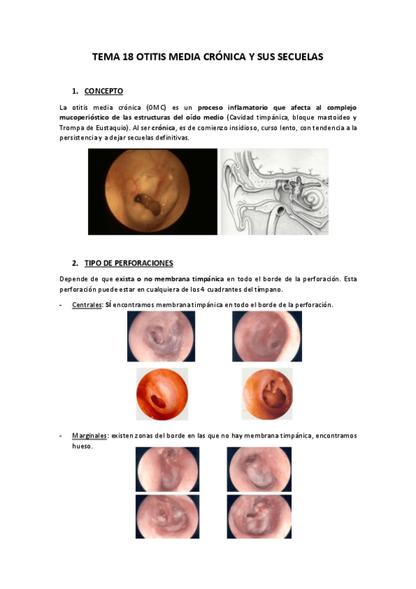 Miniatura del documento TEMA-18-OTITIS-MEDIA-CRONICA-Y-SUS-SECUELAS.pdf