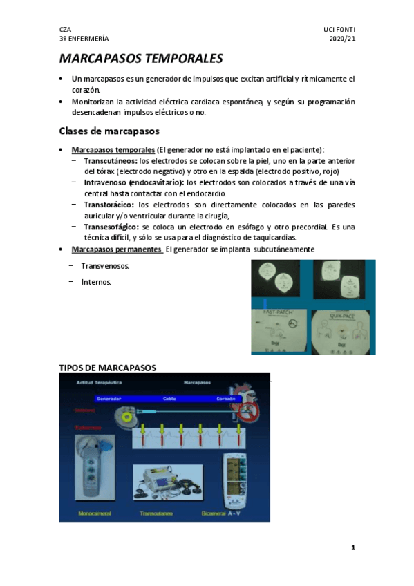 Miniatura del documento MARCAPASOS-TEMPORALES.pdf