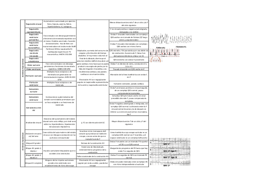 Miniatura del documento Arritmias.pdf
