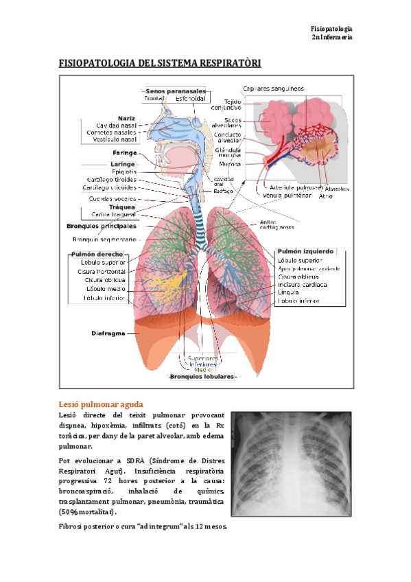 Miniatura del documento TEMA 3. Fisiopatologia del sistema respiratori.pdf