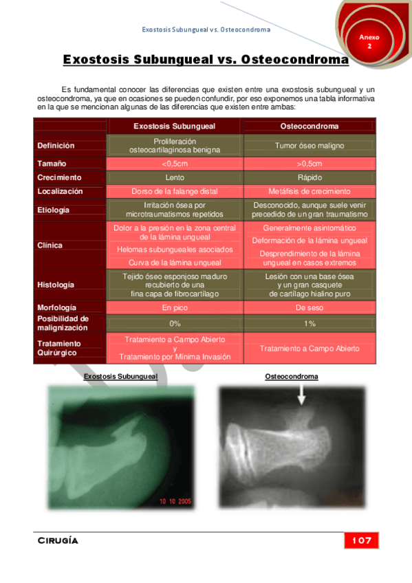 Miniatura del documento Anexo-2Exostosis-Subungueal-vs.pdf