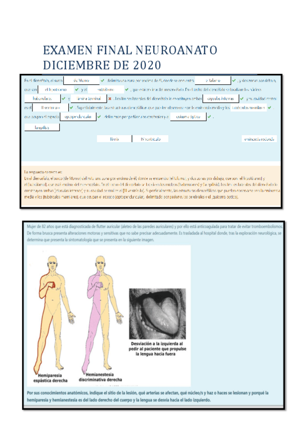 Miniatura del documento EXAMEN-FINAL-NEUROANATO-DICIEMBRE-DE-2020.pdf