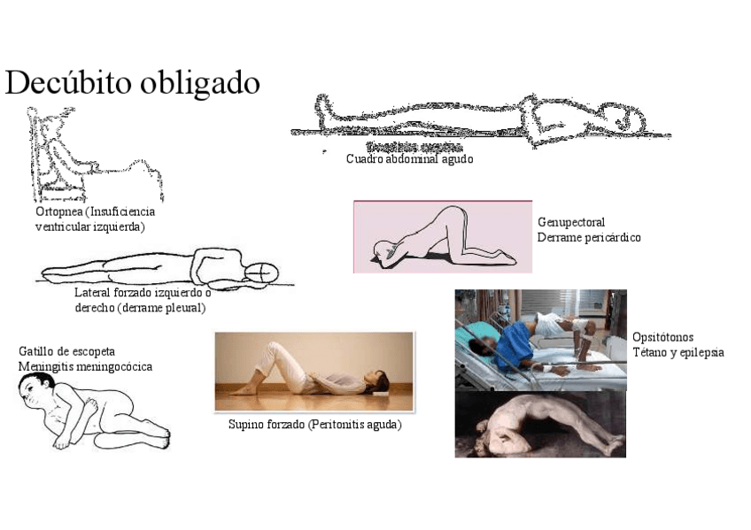 Miniatura del documento Decubito-obligado.pdf