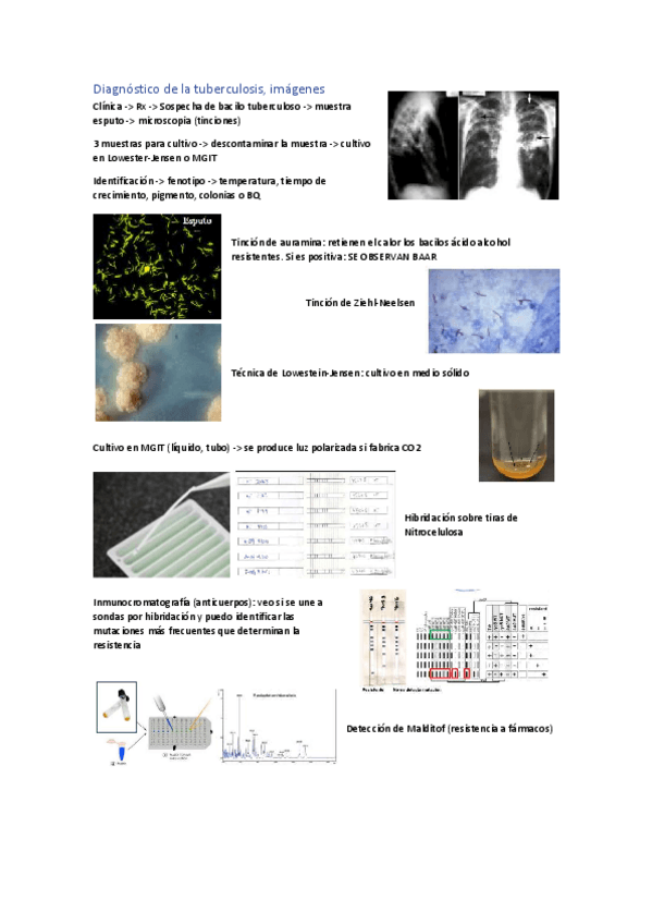 Miniatura del documento Tuberculosis-imagenes.pdf