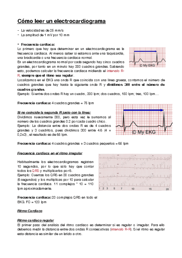 Miniatura del documento Como-leer-un-electrocardiograma-.pdf
