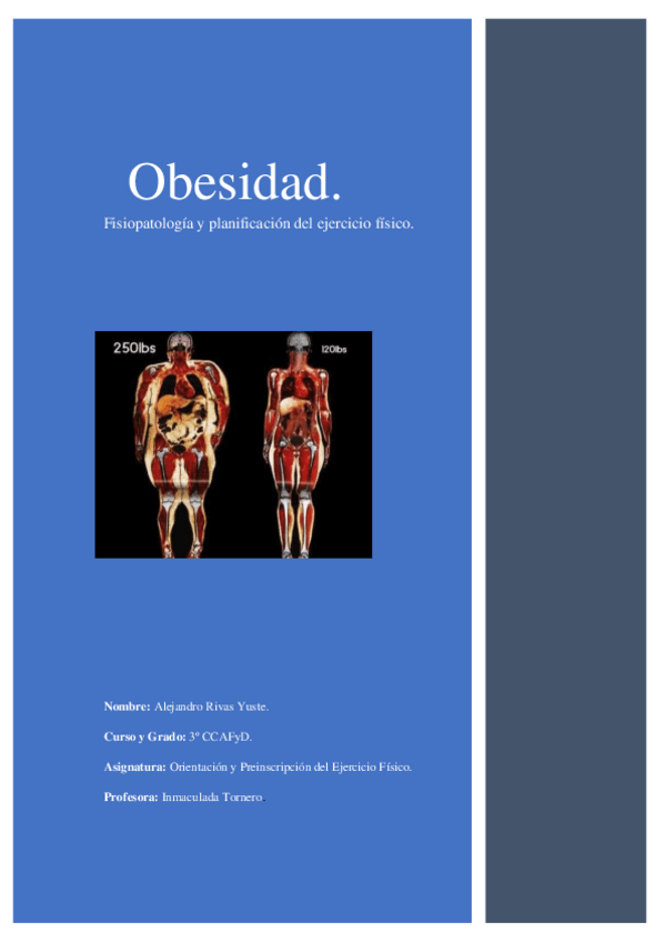 Miniatura del documento Obesidad.pdf