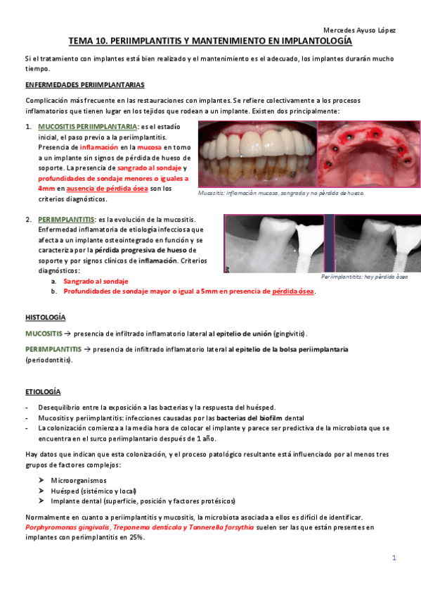 Miniatura del documento TEMA-10-cirugia-bucal-avanzada-PERIIMPLANTITIS-Y-MANTENIMIENTO.pdf