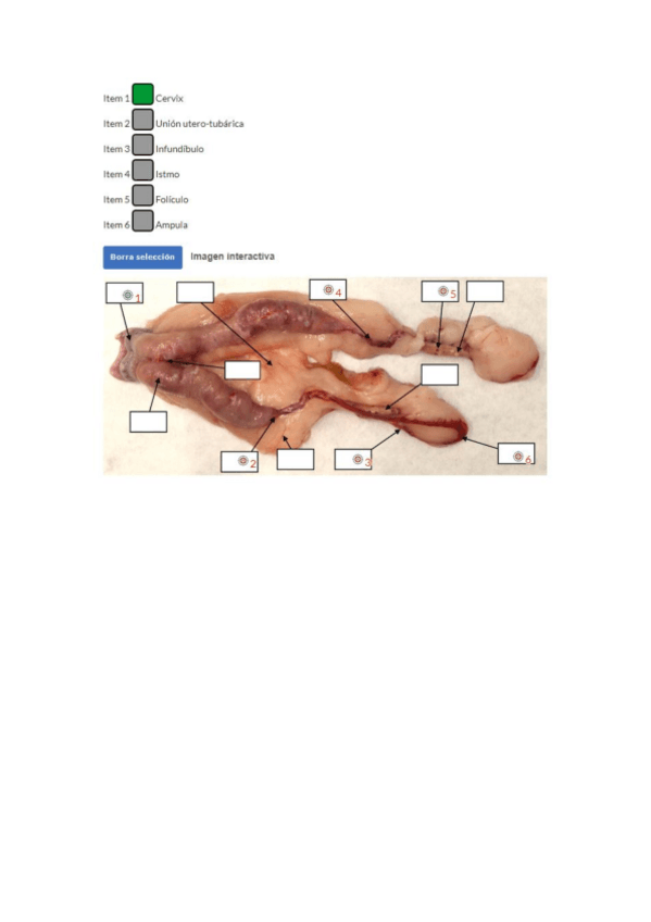 Miniatura del documento TEST-PRACTICA-APARATO-REPRODUCTOR-FEMENINO-FAH-2020.pdf