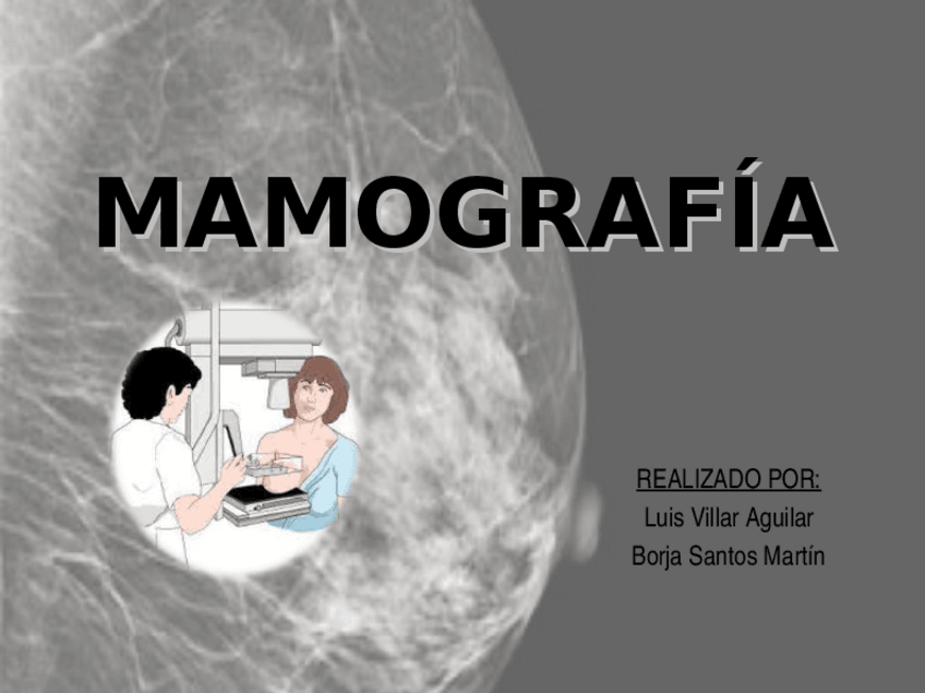 Miniatura del documento mamografia-luis-y-borja-FFE.ppt