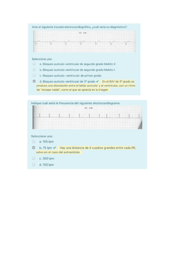 Miniatura del documento P7-Arritmias.pdf