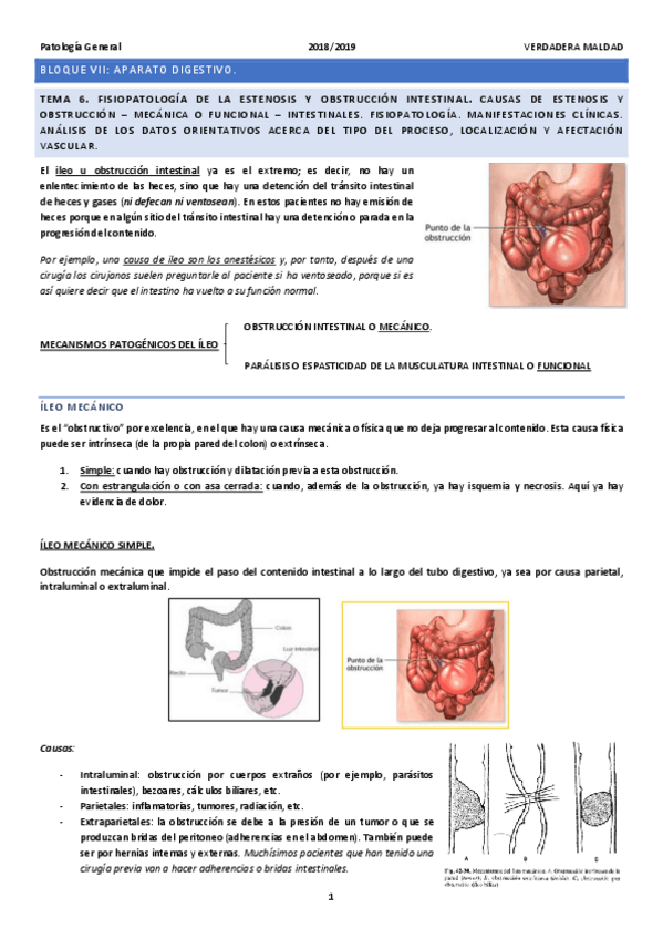 Miniatura del documento TEMA-6-FISIOPATOLOGIA-DE-LA-OBSTRUCCION-INTESTINAL.pdf