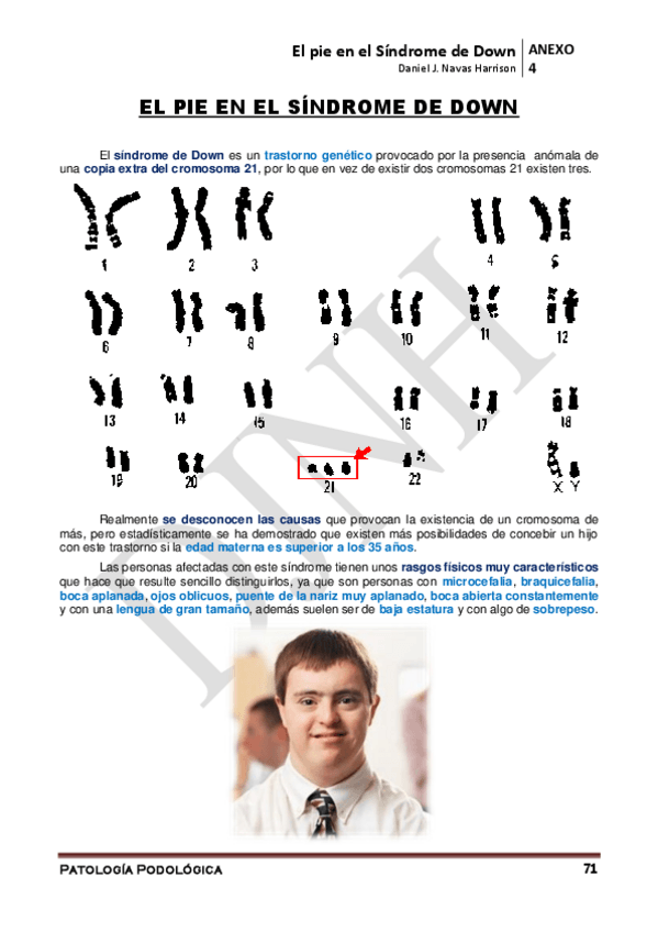 Miniatura del documento ANEXO-4o-El-pie-en-el-Sindrome-de-Down.pdf