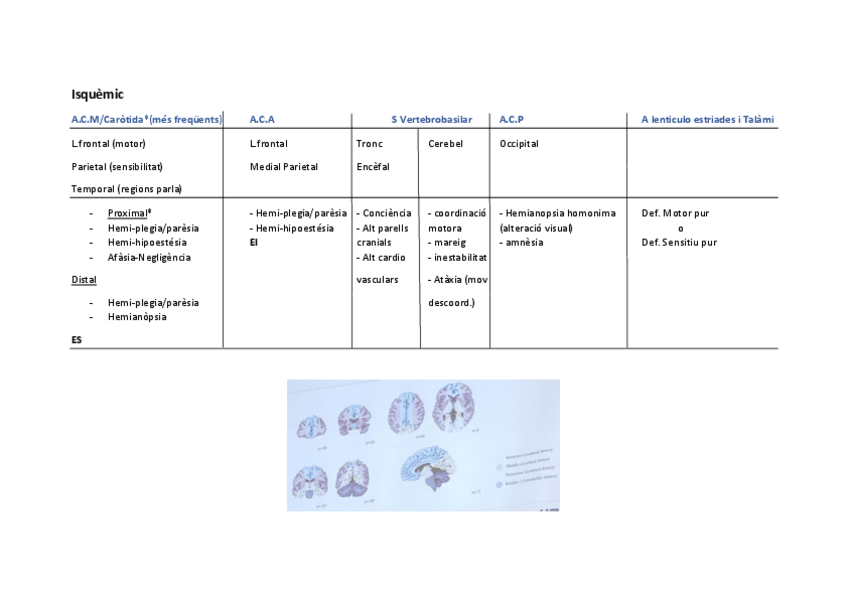 Miniatura del documento Tabla-Resumen-Arteries-cerebrals.pdf