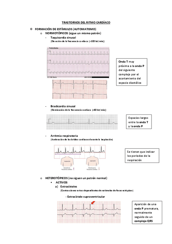 Miniatura del documento TRASTORNOS-DEL-RITMO-CARDIACO.pdf